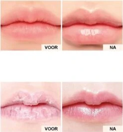 2 Stuks DAG En Nacht Lip Plumpers | Natuurlijke Lip Plumpers | 50% Vollere Lippen In 2 Min | Lip Filler | Lipgloss | Lip Maximizer | Cadeautip | In Een Schattige Cadeauverpakking! -GlowBelle Verkoopwinkel 1118x1200 2