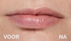 Instant Effects - 3D Lip Plumper Lipgloss Lip Filler - 20% Vollere Lippen In Slechts 2 Minuten! -GlowBelle Verkoopwinkel 1200x696 2