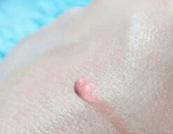 Biodermal Sun Lipbalm SPF25 - Tube 12 Ml - Natural Pink - Lippenbalsem 7 Biodermal Sun Lipbalm SPF25 - Tube 12 Ml - Natural Pink - Lippenbalsem -GlowBelle Verkoopwinkel 1200x927 2